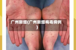 广州新增(广州新增梅毒病例)