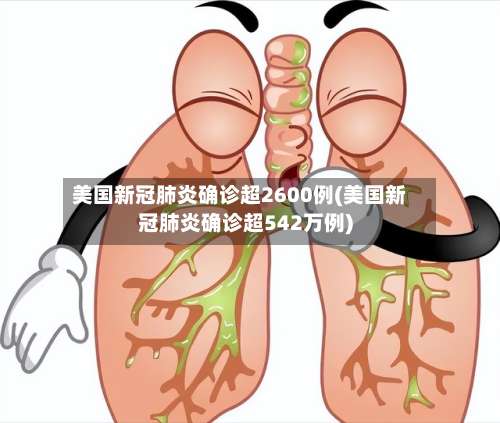 美国新冠肺炎确诊超2600例(美国新冠肺炎确诊超542万例)-第3张图片