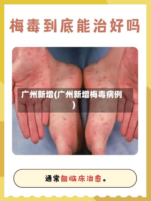 广州新增(广州新增梅毒病例)-第1张图片