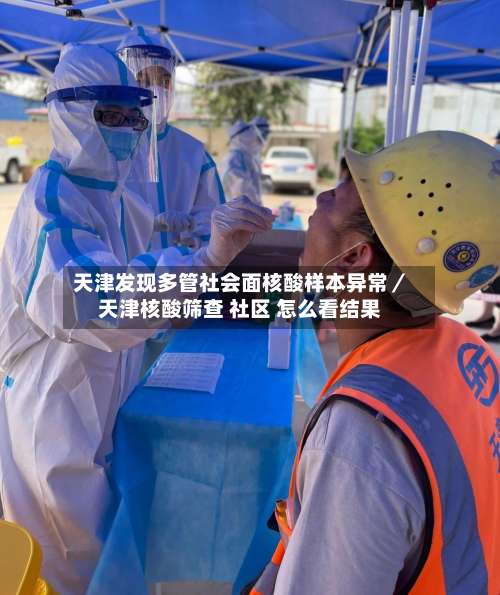 天津发现多管社会面核酸样本异常／天津核酸筛查 社区 怎么看结果-第1张图片