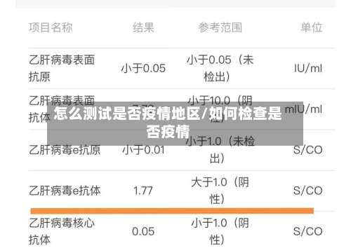 怎么测试是否疫情地区/如何检查是否疫情-第1张图片