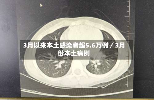 3月以来本土感染者超5.6万例／3月份本土病例-第2张图片