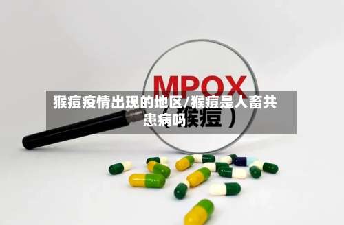 猴痘疫情出现的地区/猴痘是人畜共患病吗-第2张图片